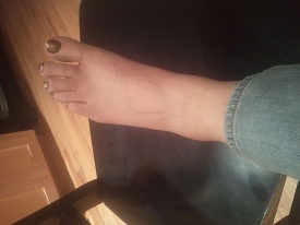 ankle